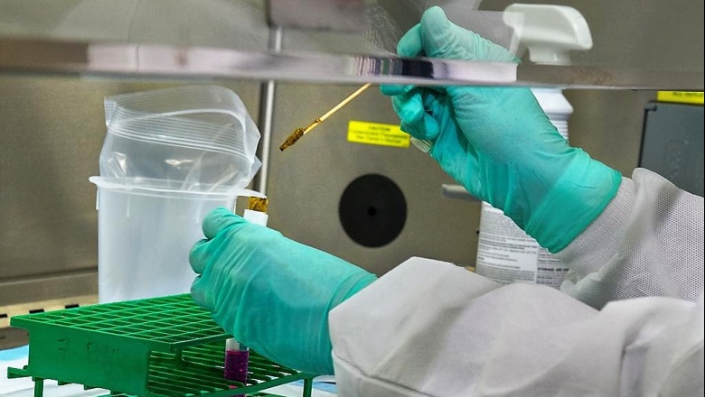 Cruzivax: La vacuna contra el chagas de la UBA que se encuentra en su fase final