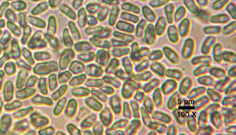 Científicos argentinos descubren en La Plata una nueva especie de hiperparásito