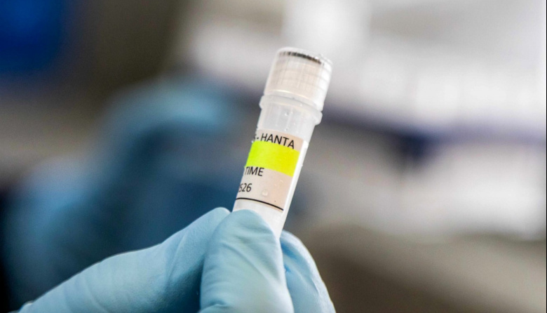 Argentina refuerza el monitoreo por hantavirus tras el brote en un crucero