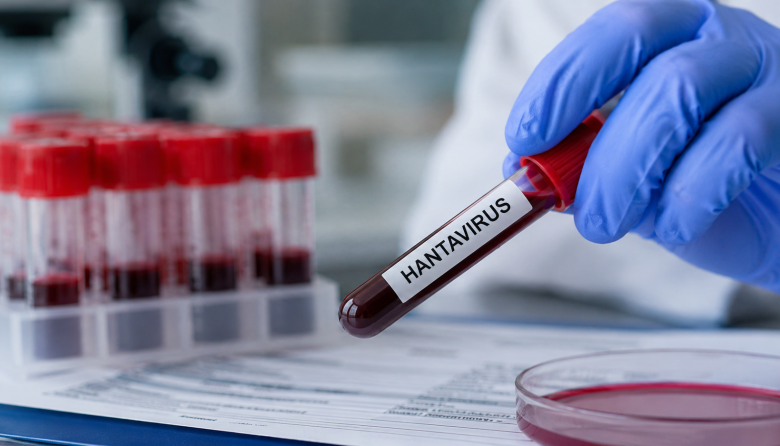 Neuquén confirma un segundo caso de hantavirus con transmisión interhumana