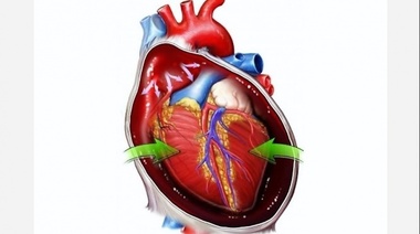 Efusión y Tamponamiento Cardíaco