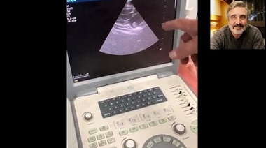 Caso de un felino con cardiomiopatía hipertrófica y trombo en atrio izquierdo