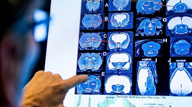 Una rata vivió dos años prácticamente sin cerebro