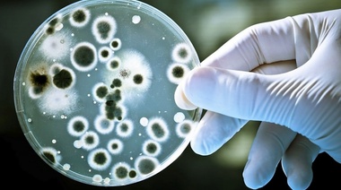 "El panorama respecto a la resistencia antimicrobiana es sombrío"