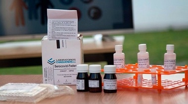 Nuevo kit de desarrollo local para detectar anticuerpos contra el SARS-CoV-2 en animales
