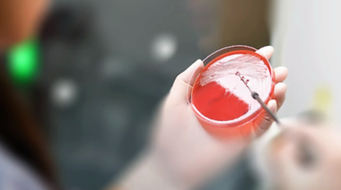 Advertencia de la OMS sobre el aumento de la resistencia a los antibióticos