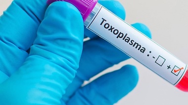 Comprueban la eficacia de un fármaco natural para el tratamiento del Toxoplasma gondii