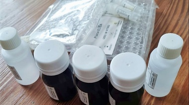 Zoocovid: Nuevo kit para identificar reservorios del SARS-CoV-2 en mamíferos