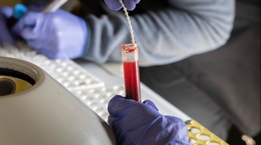 La importancia de la vigilancia epidemiológica