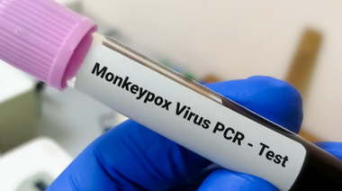 Argentina se prepara ante la eventual llegada al país de la nueva variante del virus mpox