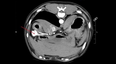 Determinan cuáles son las razas caninas con mayor riesgo de insulinoma