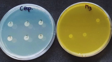 Buscan desarrollar antibióticos naturales en reemplazo de los tradicionales