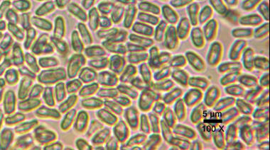 Científicos argentinos descubren en La Plata una nueva especie de hiperparásito
