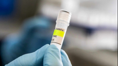 Argentina refuerza el monitoreo por hantavirus tras el brote en un crucero