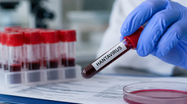 Neuquén confirma un segundo caso de hantavirus con transmisión interhumana