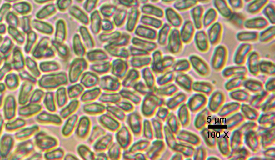 Científicos argentinos descubren en La Plata una nueva especie de hiperparásito